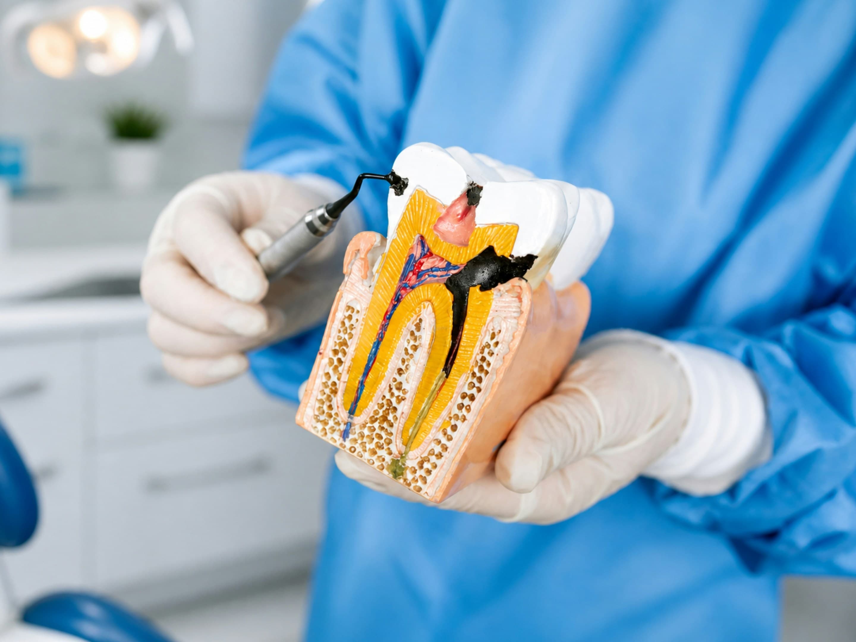 Root canal consultation for toothache at Grace Dental Care in Banasthali, Kathmandu